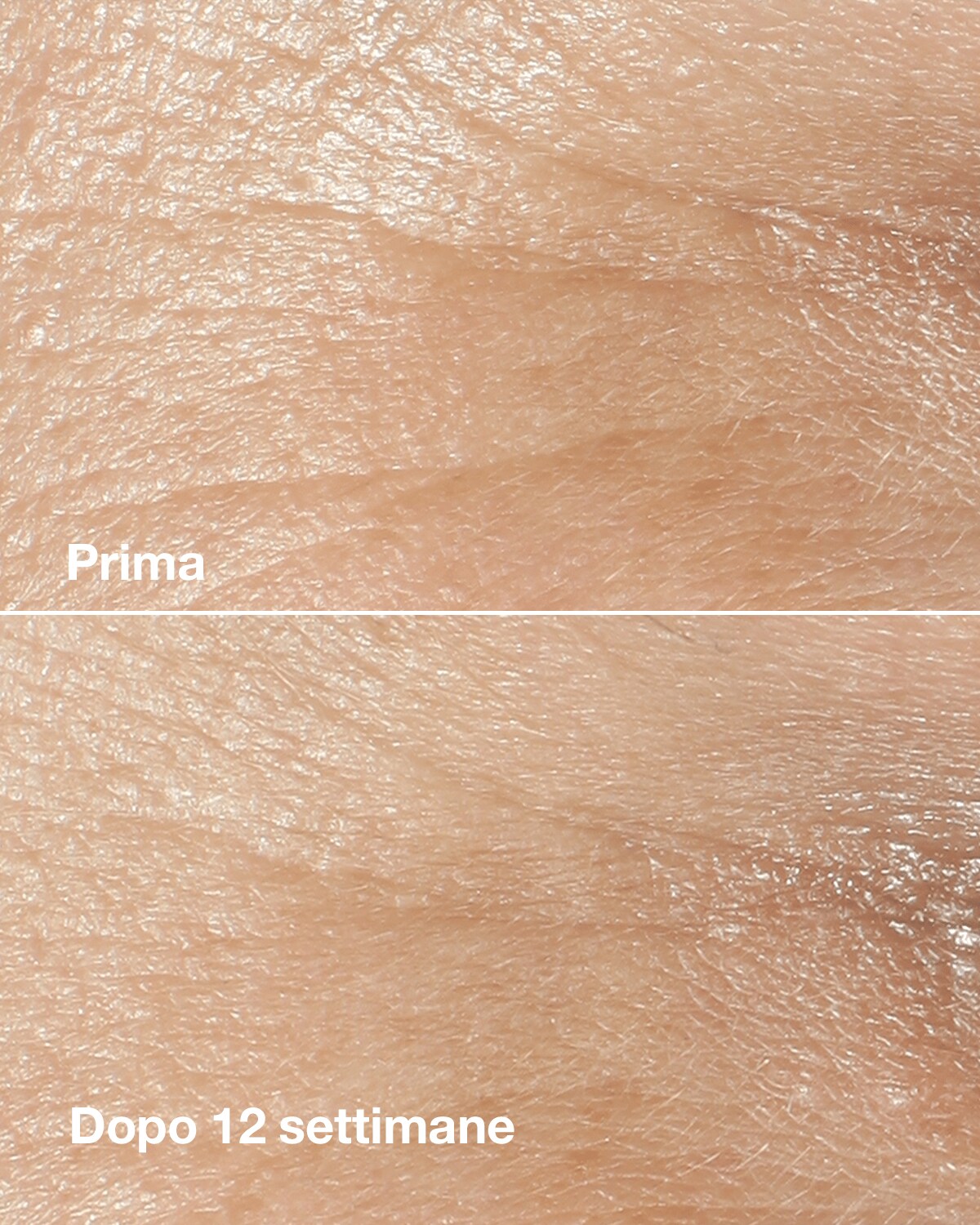 Before. After 12 weeks.